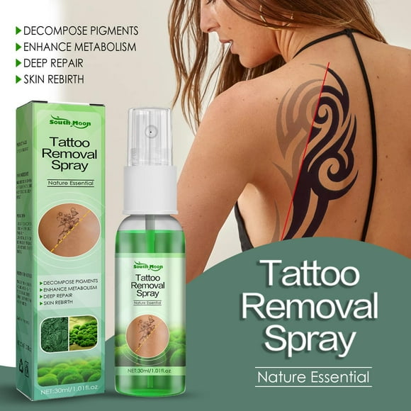 Tattoo Removal Tattoo Removal