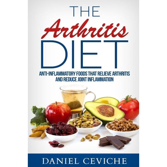 Arthritis Diet: Anti-Inflammatory Foods That Relieve Arthritis and Reduce Joint Inflammation, (Paperback)