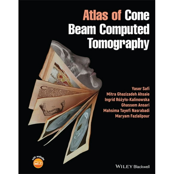 Atlas of Cone Beam Computed Tomography (Hardcover)