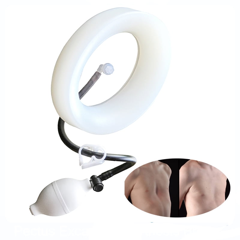 Vacuum Bell Pectus ExcavatumSternal Depression SupportPectus