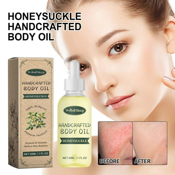 Oefntac up to 40% off Gifts Massage Oil Honeysuckle Inflammatory Regulatory Oil 30ml Natural Solution for Wellness and Healing