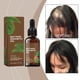thumbnail image 5 of Aceite esencial Extractos de aceite Aceite y romero Aceite capilar Aumenta la resiliencia del cabello Reduce la rotura 30 ml Esencia para el cuidado del cabello, 5 of 5