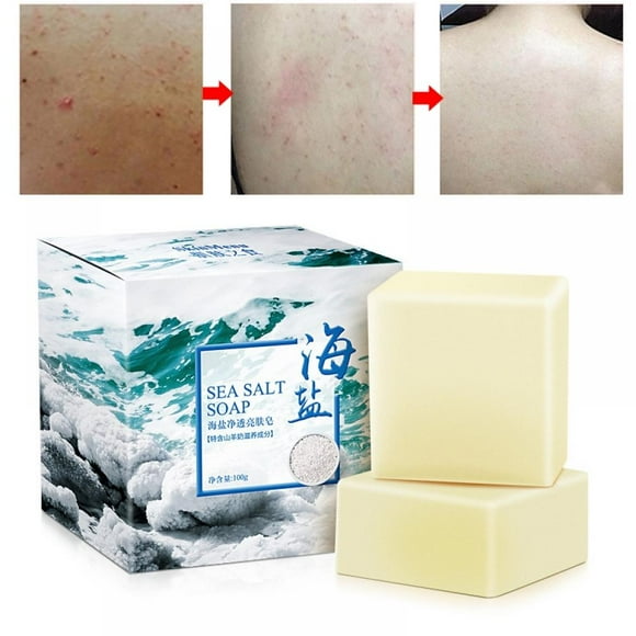 Soap For Dry Sensitive Skin