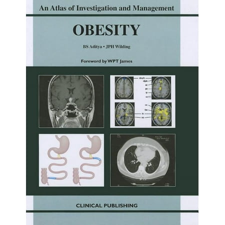 UPC: 9781846920271 | Obesity