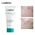 thumbnail image 1 of Leche para la limpieza del acné con oligopéptidos LANBENA, 1 of 7