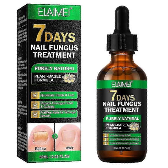 Nail Fungus Treatment, Ginger Nail Fungus Treatment, 7 Days Nail Fungus Treatment for Toenail