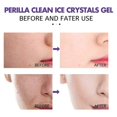 thumbnail image 3 of Perilla Pure Cleansing Ice Crystal Gel Cleansing Whitening Gel, 3 of 4