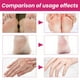 thumbnail image 4 of Calcetines Hidratantes Para El Cuidado De Los Pies, Calcetines De Pedicura Suaves De Cobertura Total Antideslizantes Para Pies Secos Y Agrietados, 4 of 7