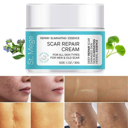 St. Mege Scar Removal Cream, Scar Cream For Old Scars - Stretch Mark Removal Cream for Men & Women, Natural Formula