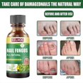 thumbnail image 3 of Tratamiento de hongos en las uñas de los pies con aceite de árbol de té, 3 of 5