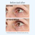thumbnail image 3 of Strivectin Baume Contour pour les Yeux, 3 of 5