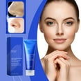 Big Blackheads: A Skincare Expert'S Guide To Clear Skin - j1yh1i8