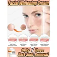 thumbnail image 2 of Suero hidratante para la piel, esencia blanqueadora y blanqueadora de pecas, aclara el Chloasma, repone el agua, embellece la piel, 2 of 5