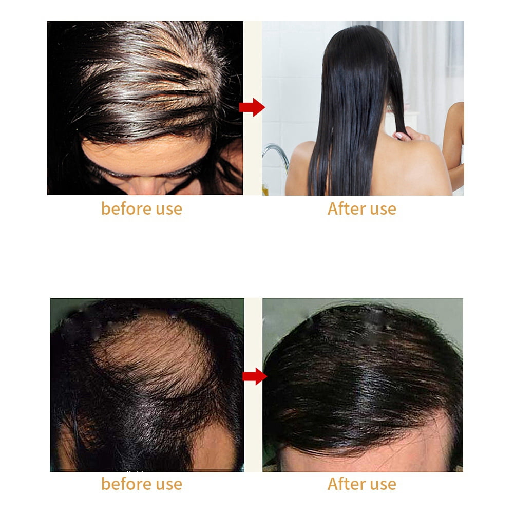 combing hair for hair growth