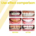 thumbnail image 3 of Propolis Gum Care Gel, Propolis Gum Gel, Propolis Teeth Regrowth Dental Gel, Gum Gel New Arrival, 3 of 5
