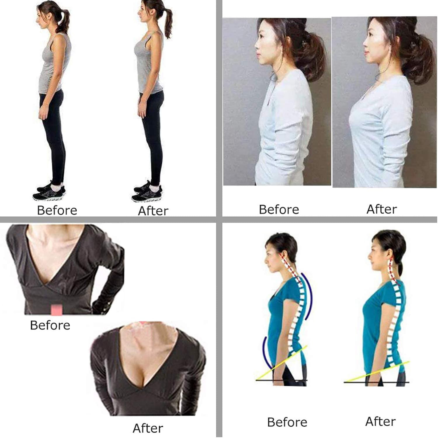 MISS MOLY Posture Corrector Bra for Women Back Support Vest Chest Brace Up Prevent Hunchback Sagging Posture Corset Shapewear