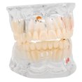 thumbnail image 1 of Modelo de enseñanza de dientes Modelo de patología Modelo patológico Estudio de enseñanza dental Modelo de dientes de demostración para laboratorio dental Investigación hospitalaria Dientes anatómicos, 1 of 9