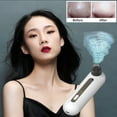 thumbnail image 1 of MZCPSYHA Suction Blackhead Instrument Pore Cleaner Household To Blackhead Facial Cleaning Small Inducer, 1 of 7