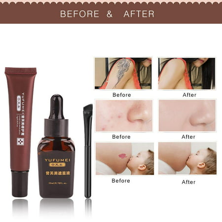 Yosoo Skin Repair Cream Scar, Professional Makeup Cover Up Liquid Waterproof Kit for Coverage Vitiligo Cover Hiding Spots Birthmarks Concealer