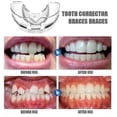 thumbnail image 5 of 2024 Dental Orthodontic Teeth Corrector Silicone Braces Retainer Straighten Tools Teeth Capped for Adults, 5 of 5
