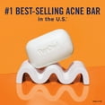 thumbnail image 6 of PanOxyl Acne Treatment Face & Body Bar Soap, Max Strength 10% Benzoyl Peroxide, All Skin Types, 4 oz, 6 of 10
