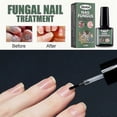 thumbnail image 4 of Extra Strength Nail Repair Fluid Toenail And Nail Solution Toenails And Nails Repair Damaged And Discolored Nails Natural Supplies, 4 of 5