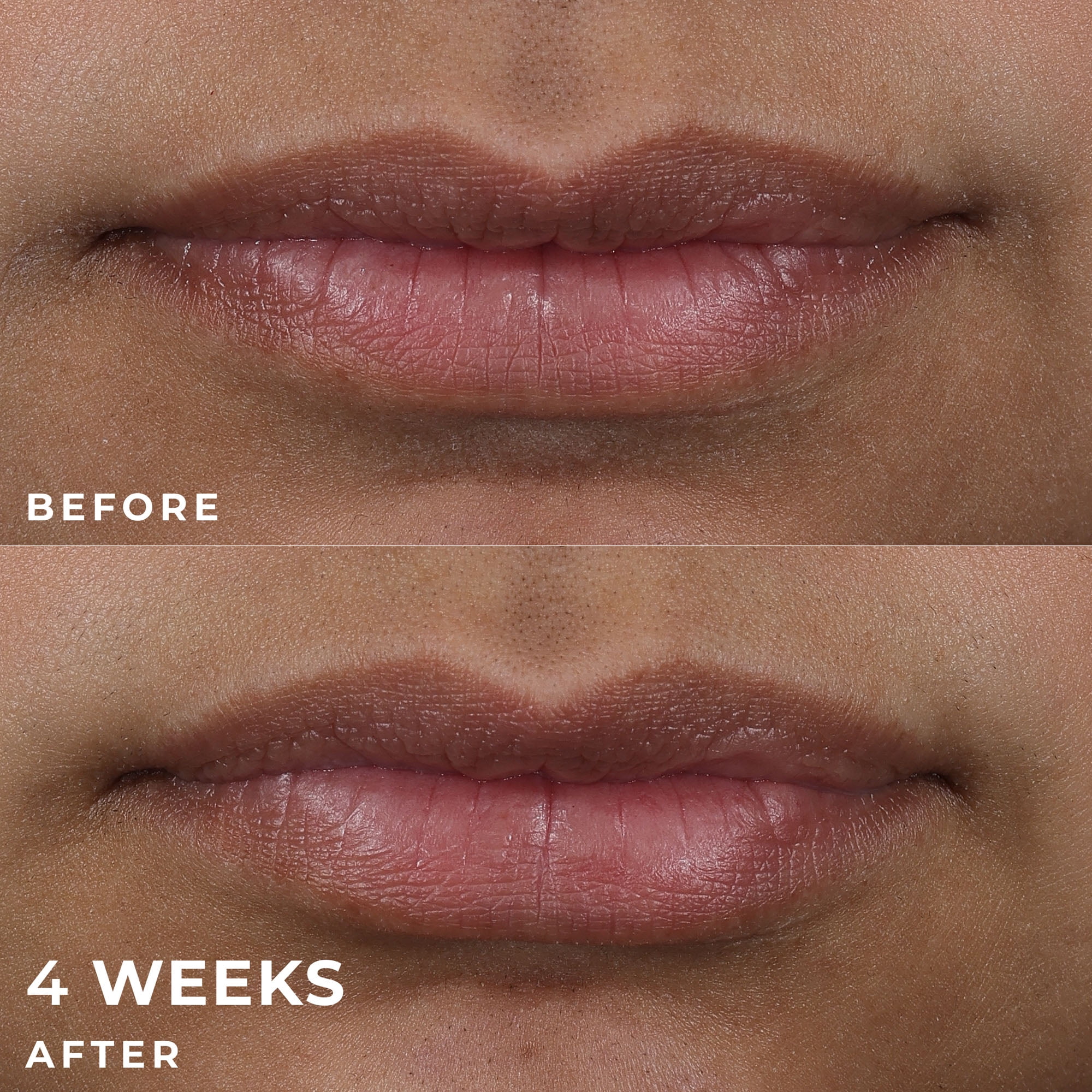RoC Derm Correxion Lip Volumizer Lip Plumper with Hyaluronic Acid + Pro-Collagen Peptide*, 48-Hour Hydration, Fragrance-Free, Non-Sticky, 0.34 fl oz