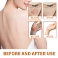 thumbnail image 3 of Crema para psoriasis con veneno de abeja (1/3/5 unidades), alivia el enrojecimiento y la picazón, repara la piel de manos y pies, para todo tipo de piel., 3 of 5