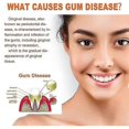 thumbnail image 3 of EELHOE Teeth Repair Bottle Tooth Decay Repair Repair All Tooth Decay And Protect Teeth Remove Plaque Tooth Decay Repair Tooth W, 3 of 5