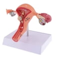thumbnail image 1 of Female Uterus Structure Biological Models Educational Experiment, 1 of 4