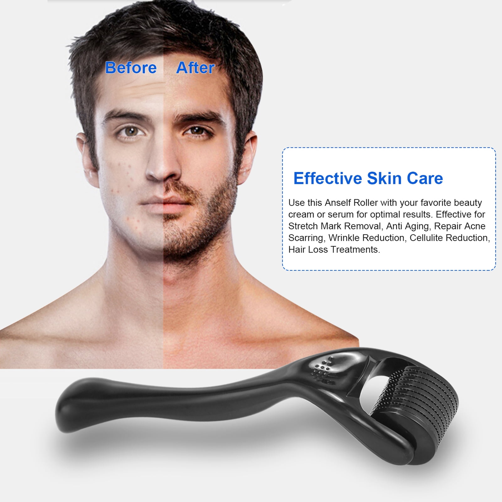 Abanopi 540 Derma Roller 0.25mm Titanium Beard Roller for Hair Regrowth  Beard Growth -Hair Loss Skin Care - Walmart.com