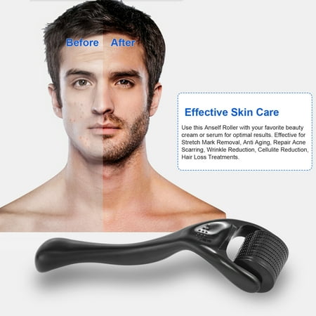 540 Derma Roller  Titanium Beard Roller for Hair Regrowth Beard Growth  Anti-Hair Loss Skin Care Treatment | Walmart Canada