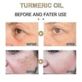 thumbnail image 5 of 30ml Turmeric Oil Pure Natural Pleasant Moisturizi, 5 of 5