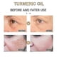 thumbnail image 5 of 30ml Turmeric Oil - Pure, Natural, Moisturizing, Anti-aging Serum f, 5 of 5