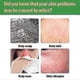 thumbnail image 3 of 12pcs Bags Dust Mites Killer Mite Eliminator Nature For Bed Sheet Sofa - Hz, 3 of 4