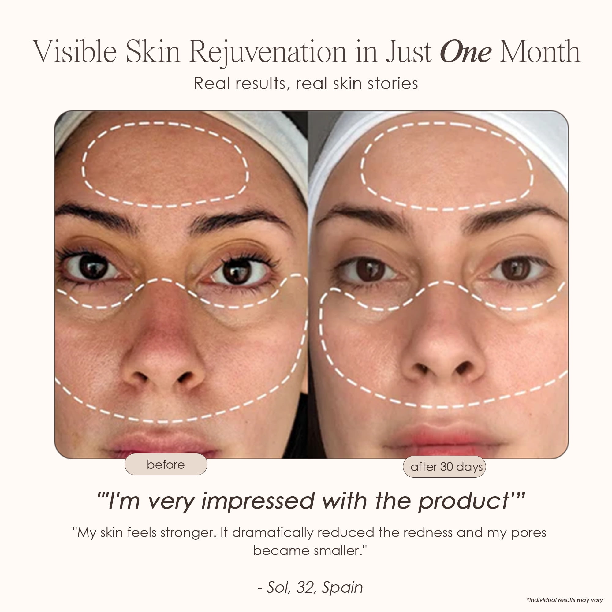 Project E Beauty Lumamask Pro Facial Skin Device | LED Light
