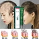 thumbnail image 2 of Aceite Esencial de jengibre Natural para el cuidado del cabello, 2 of 5
