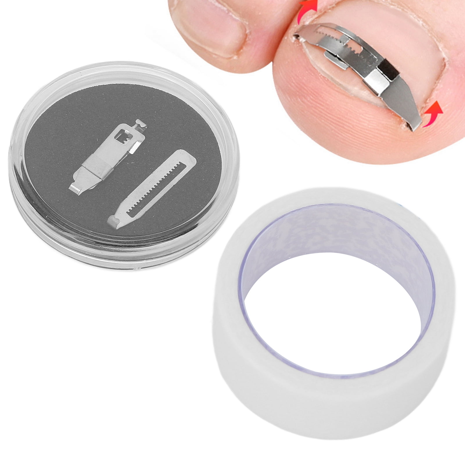 Ymiko Ingrown Toenail Brace,Paronychia Correction Brace,Ingrown Toenail