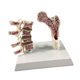 thumbnail image 5 of Modelo de anatomía de osteoporosis de fémur humano Aprenda accesorios de esqueletos Herramienta educativa para suministros escolares enseñando hogar, 5 of 8