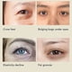 thumbnail image 3 of Varita Eléctrica Del Masajeador De Ojos, Masajeador Eléctrico Portátil De Los Ojos Con Detección Inteligente Para El Hogar Para Las Ojeras, 3 of 7