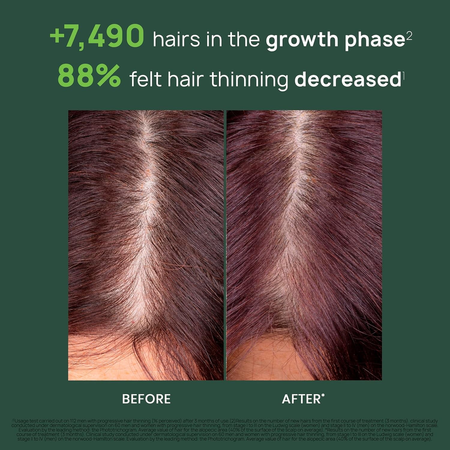 Rene Furterer Triphasic Progressive Concentrated Serum - For Hereditary, Hormonal Thinning Hair - 8 Vials, 30-Day Supply