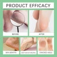 thumbnail image 6 of TyTqxy Foot Nourishing Spray for Dry Skin - Moisturizes & Softens Feet, Prevents Dryness, Refreshing Fast-Absorbing Care, Keep Fresh Odor-Free Daily Use 20ml​​, 6 of 9