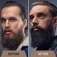 thumbnail image 3 of Striking Viking Beard Oil Set 2 Pack Sandalwood with Derma Roller Biotin Beard Care Kit for Men, 3 of 6