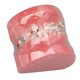 thumbnail image 3 of Modelo Dental de Ortodoncia NikouMX Resina, 3 of 8