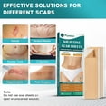 thumbnail image 3 of Silicone Scar Sheets, Silicone Scar Tape(5.7” x 1.57” 10 Pcs), Scar Removal Away Strips for Surgical Scars, Keloid, C-Section, Burn et, 3 of 7