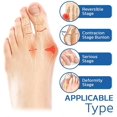 thumbnail image 3 of ORUYROP Align Toe Socks for Bunion (Black+Skin*10), 3 of 7