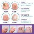thumbnail image 2 of Medinail Fungus Spray,toenail Fungus Treatment-nail Fungus Treatment For Toenail, 2 of 4