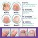 thumbnail image 2 of Medinail Fungus Spray,toenail Fungus Treatment-nail Fungus Treatment For Toenail, 2 of 4