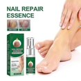 thumbnail image 4 of Nail Repair Essence Fungus Treatment Anti Fungal Infection For Toe Nail Nail, 4 of 5
