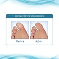 thumbnail image 6 of Funginix AF Athlete's Foot Cream, Maximum Strength Athlete's Foot & Anti-Fungal Remedy, 2 Tubes, 6 of 6